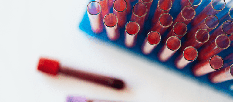 EMB bloedtest - Perfect Health